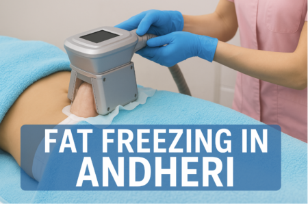 Fat Freezing in Andheri